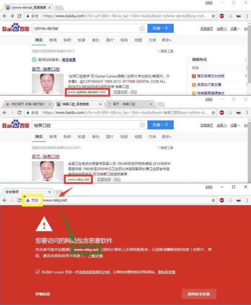 百度優化后的“瑞泰口腔”搜索結果