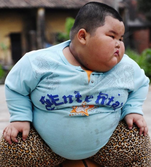 4歲小胖墩睡夢中去世 睡覺時易打呼且有呼吸短暫性暫停的現象